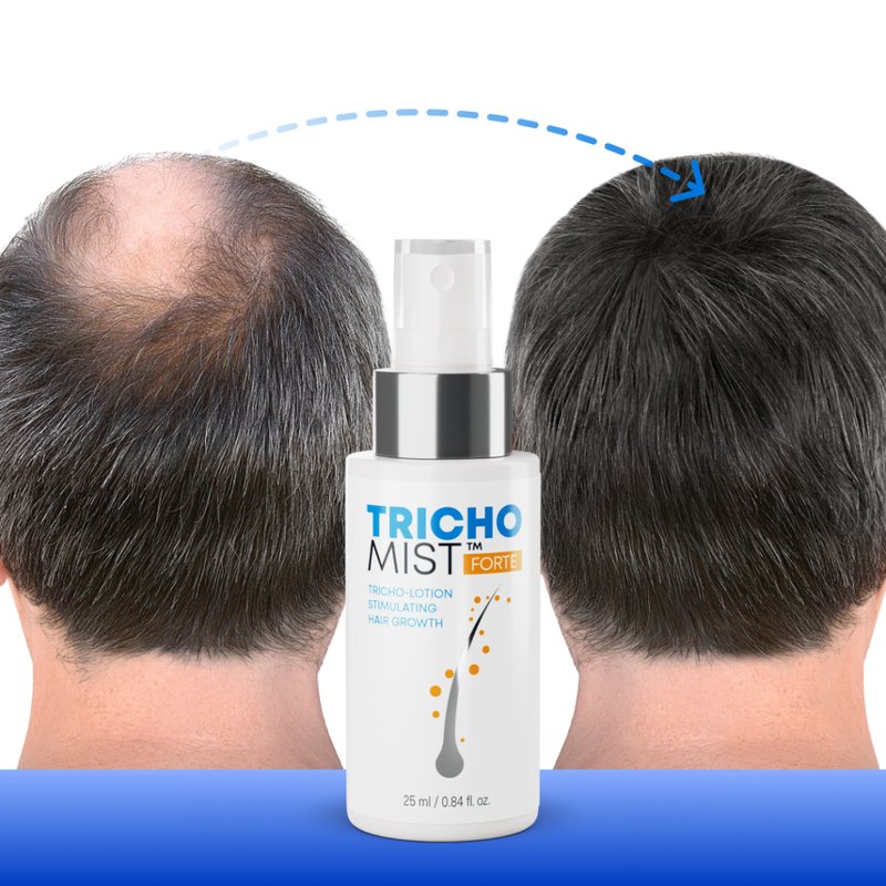 Image: Tricho Mist Suplement: Rozwiązanie dla Problemów z Włosami